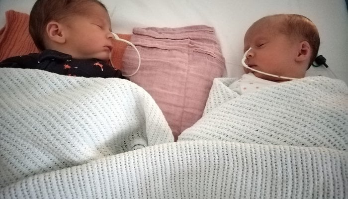 Sleeping twins with feeding tubes